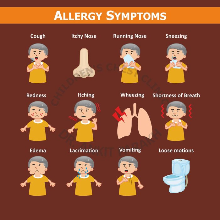 Allergy symptoms children common symtoms Allergies in children