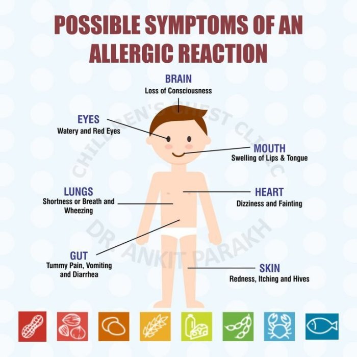 Symptoms allergies allergy allergic possible childhood Allergies in children