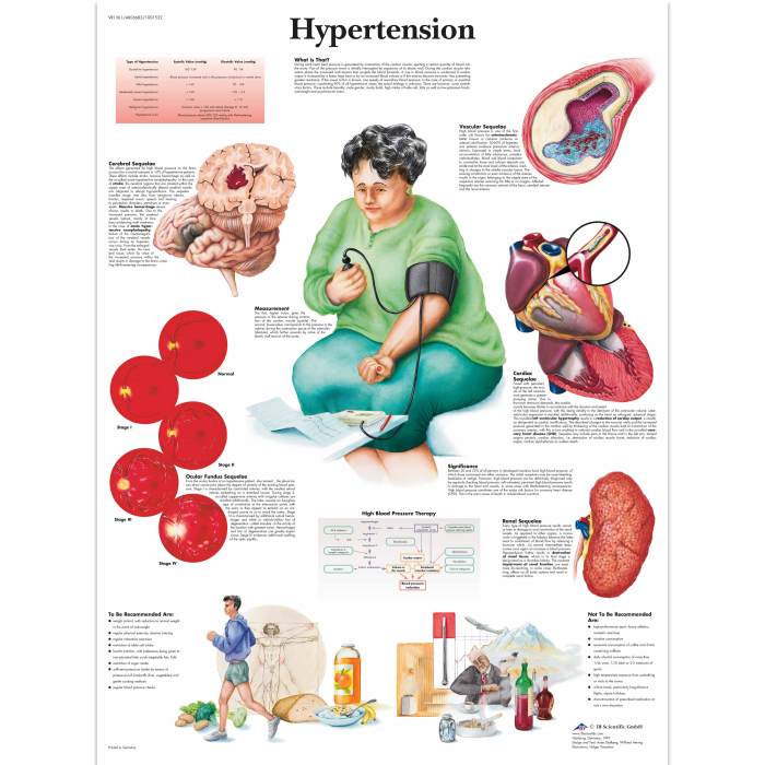 Hypertension disease pathophysiology causes systolic artery essay risks Hypertension and heart health